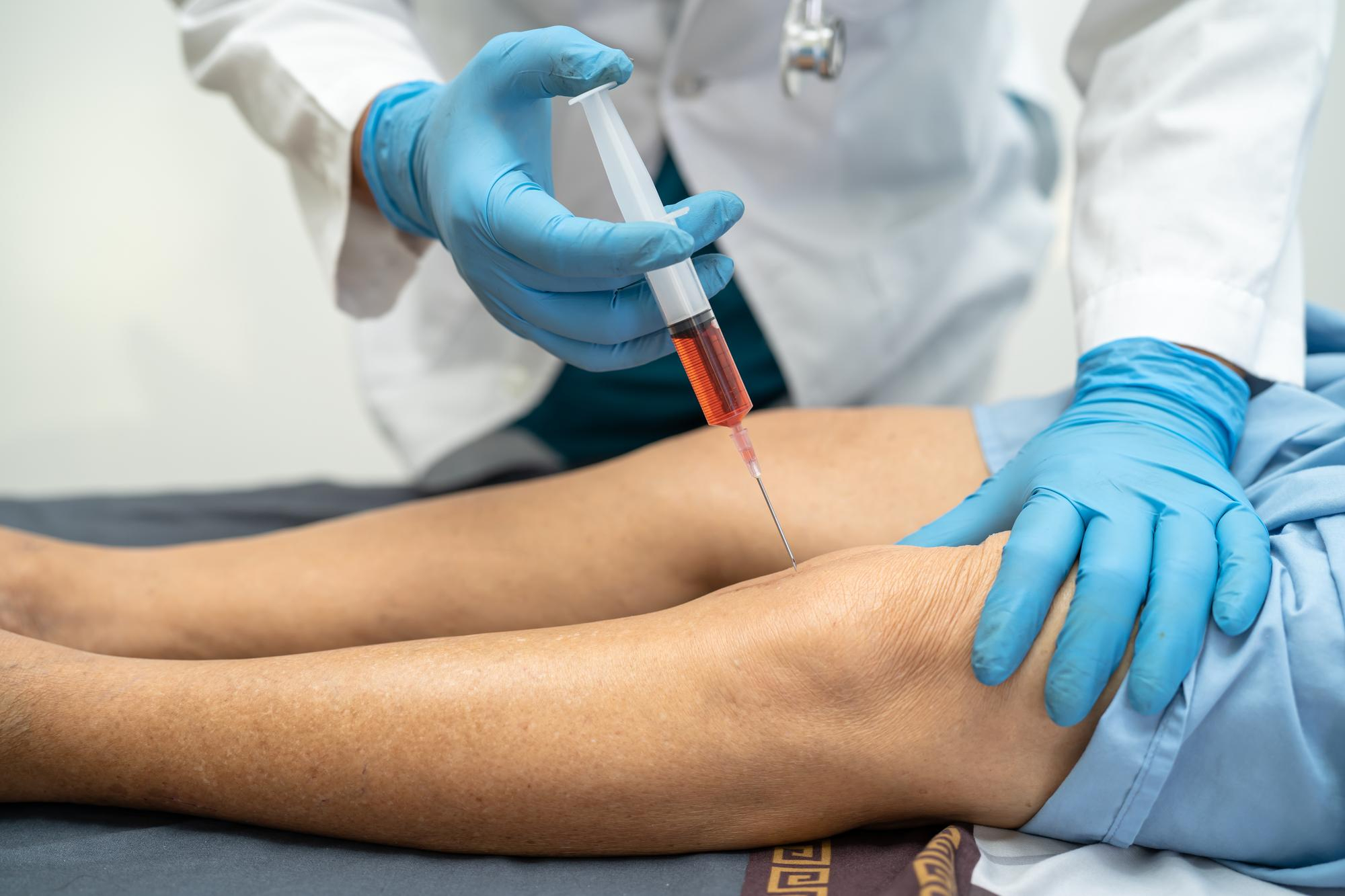 PRP suitability evaluation for knee arthritis and joint pain